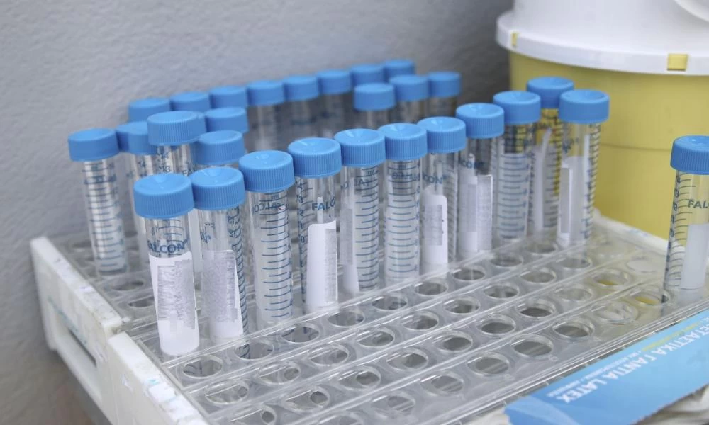 Ζαούτης: Γιατί να μην κάνετε τεστ αντισωμάτων μετά τον εμβολιασμό